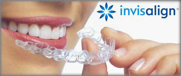 Melissa, TX Invisalign Orthodontics | Paradise Dental